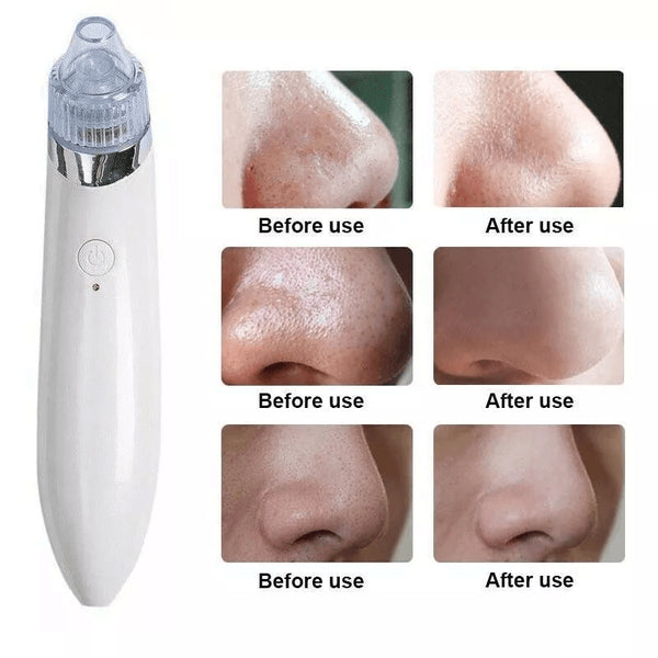 Electric Facial Skin Care Pore Blackhead Cleaner